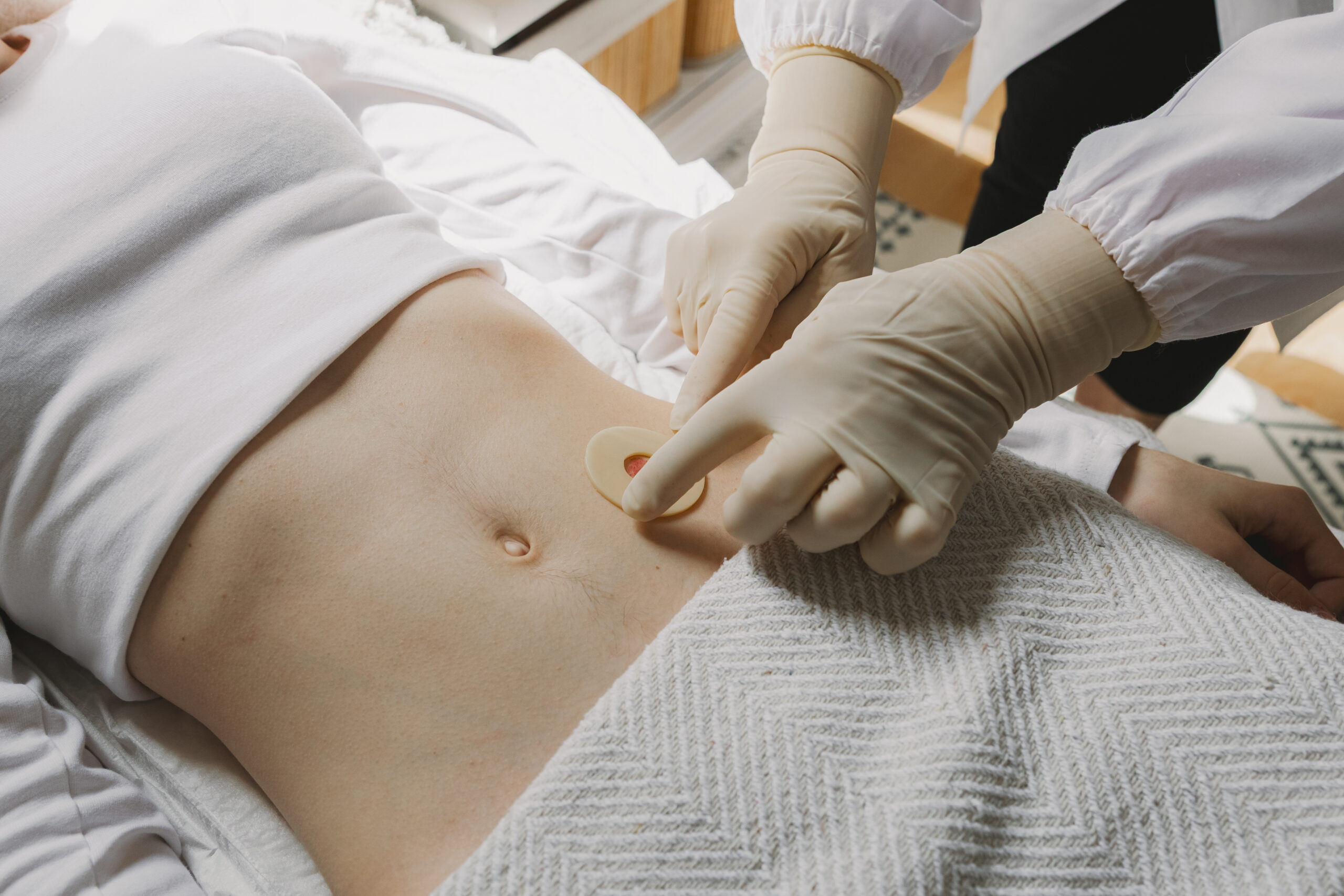 Appendectomy in Victorville