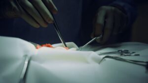 closeup-surgeon-hands-operating-clinic-sterile-ward-medical-team-cooperate